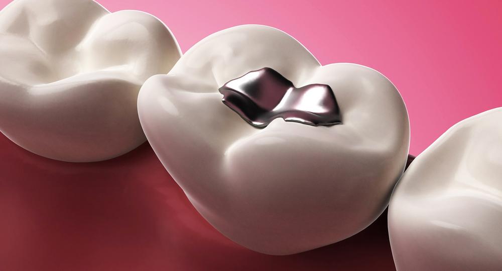 News Aesthetic Dental Designs